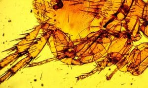 Vết cắn của Bọ chét