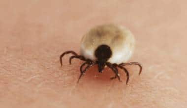 Sốt phát ban Rocky Mountain